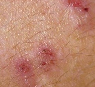 皮肤瘙痒是由哪些原因引起的？